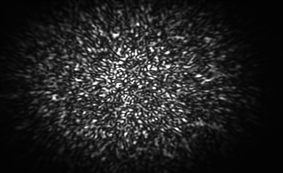 Imatge fixa d’speckle enregistrat amb el sistema ‘Best Pixel’ mentre sonava la cançó ‘Another one bites the dust’ del grup ‘The Queen’